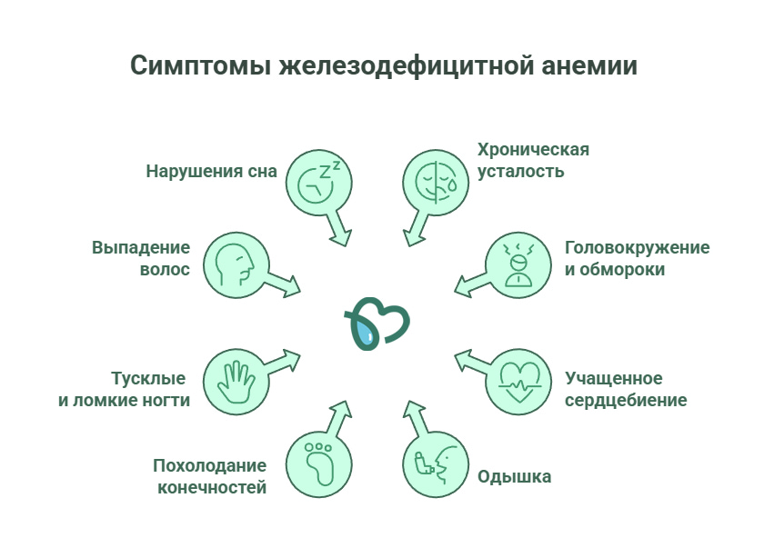 Симптомы анемии (инфографика)